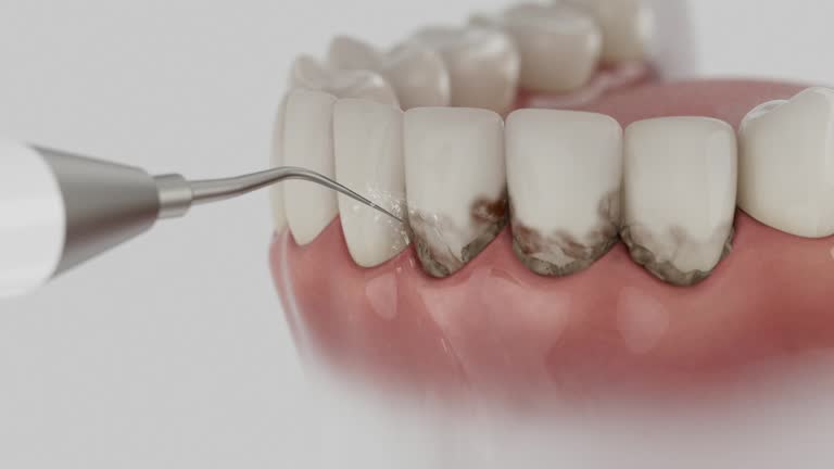 Trusted Wisdom Tooth Removal service in Mount Carmel, TN - Dentist Open Now